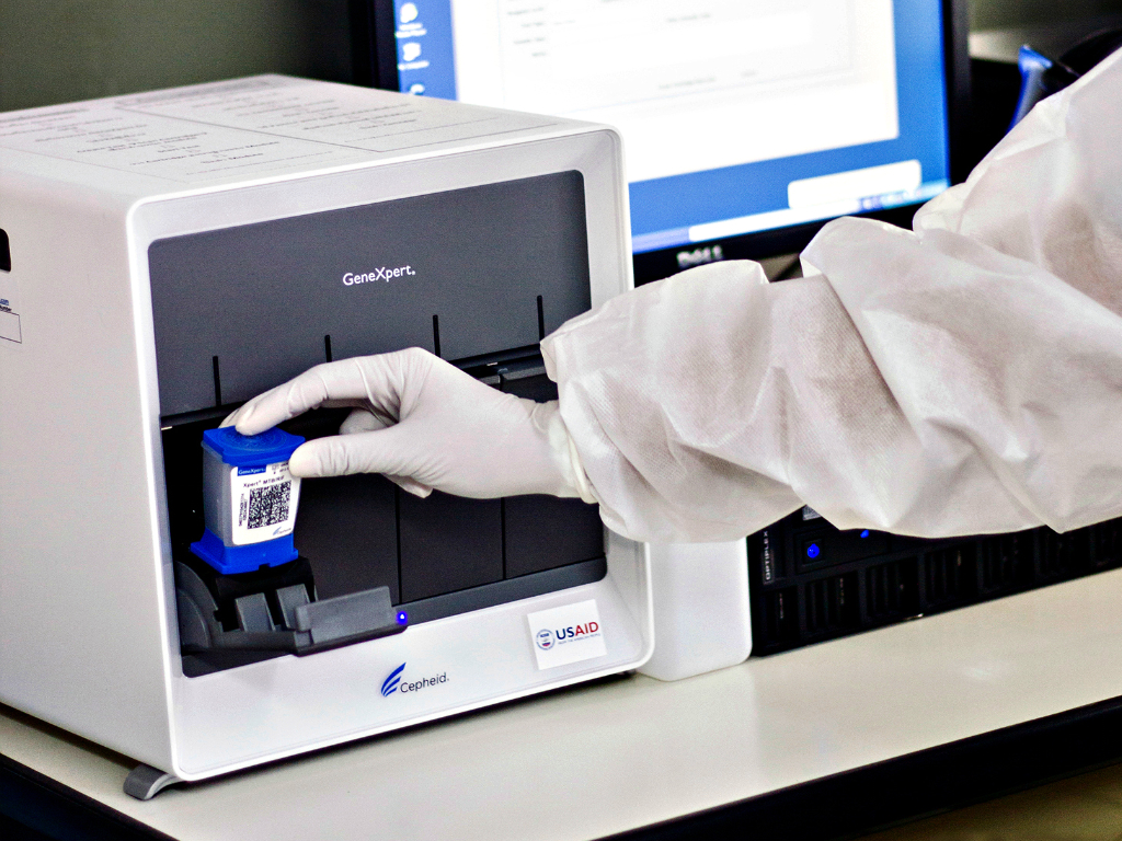 No momento, você está visualizando Maracanaú é contemplado com equipamento para Diagnóstico de Tuberculose com maior precisão e rapidez