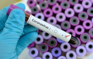 Read more about the article Secretaria da Saúde alerta sobre o Coronavírus e dá dicas de prevenção